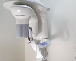 Ortopantomografia Digitale (OPT)
